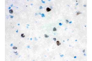 Anti- VCP Picoband antibody, IHC(F): Rat Brain Tissue