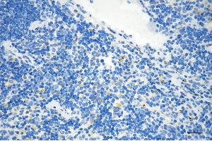 anti-Myocyte Enhancer Factor 2A (MEF2A) antibody