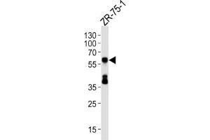 Western Blotting (WB) image for anti-delta Like Protein 3 (DLL3) antibody (ABIN5024655) (DLL3 Antikörper)