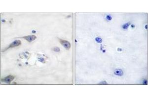 Immunohistochemistry analysis of paraffin-embedded human brain tissue, using DARPP-32 (Ab-75) Antibody. (DARPP32 Antikörper  (AA 41-90))