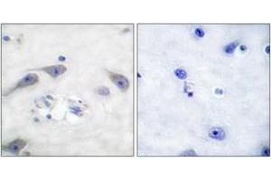 Immunohistochemistry analysis of paraffin-embedded human brain tissue, using DARPP-32 (Ab-75) Antibody. (DARPP32 Antikörper  (AA 41-90))