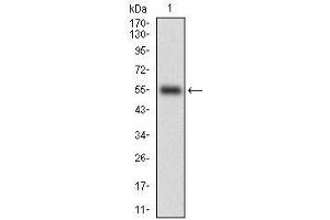 Western blot analysis using CD38 mAb against human CD38 (AA: Extra(43-300)) recombinant protein. (CD38 Antikörper  (AA 43-300))