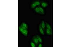 Immunofluorescent analysis of HepG2 cells using ABIN7161932 at dilution of 1:100 and Alexa Fluor 488-congugated AffiniPure Goat Anti-Rabbit IgG(H+L) (NXF1 Antikörper  (AA 1-130))