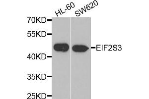 Western blot analysis of extracts of various cell lines, using EIF2S3 antibody (ABIN5975415) at 1/1000 dilution. (EIF2S3 Antikörper)