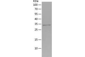 Western Blotting (WB) image for Mitochondrial Amidoxime Reducing Component 2 (MARC2) (AA 224-308) protein (His-IF2DI Tag) (ABIN7282257) (MARC2 Protein (AA 224-308) (His-IF2DI Tag))