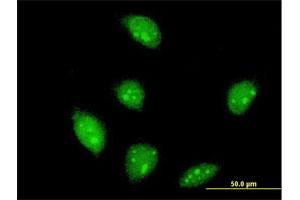 Immunofluorescence of monoclonal antibody to FLI1 on HeLa cell. (FLI1 Antikörper  (AA 1-452))