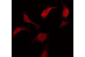 ABIN6275984 staining Hela by IF/ICC. (LPAR3 Antikörper  (Internal Region))