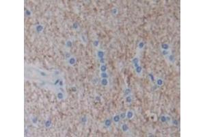 IHC-P analysis of Human Tissue, with DAB staining. (IFNA5 Antikörper  (AA 22-189))