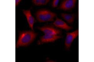 Immunofluorescenitrocellulosee of human HeLa cells stained with Hoechst 3342 (Blue) for nucleus staining and monoclonal anti-human BAK1 antibody (1:500) with Texas Red (Red). (BAK1 Antikörper  (AA 29-187))