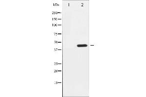 Western blot analysis of Tyrosine Hydroxylase phosphorylation expression in Insulin treated 293 whole cell lysates,The lane on the left is treated with the antigen-specific peptide. (Tyrosine Hydroxylase Antikörper  (pSer19))
