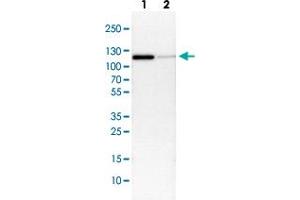 Western Blot (Cell lysate) analysis with CTNND1 polyclonal antibody  Lane 1: NIH-3T3 cell lysate (Mouse embryonic fibroblast cells) Lane 2: NBT-II cell lysate (Rat Wistar bladder tumour cells)