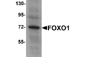 Western Blotting (WB) image for anti-Forkhead Box O1 (FOXO1) (N-Term) antibody (ABIN1031383) (FOXO1 Antikörper  (N-Term))