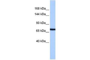 PCDH15 antibody used at 1 ug/ml to detect target protein. (PCDH15 Antikörper  (N-Term))