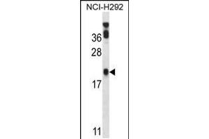 Western blot analysis in NCI-H292 cell line lysates (35ug/lane). (PERP Antikörper  (C-Term))