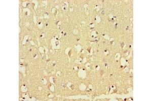 Immunohistochemistry of paraffin-embedded human brain tissue using ABIN7172553 at dilution of 1:100 (GATA6 Antikörper  (AA 496-595))