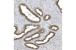 IHC analysis of PKC Theta/PRKCQ using anti-PKC Theta/PRKCQ antibody (ABIN7600767).
