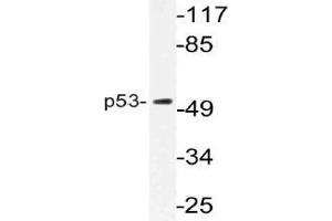 Western blot (WB) analysis of p53 antibody in extracts from K562 cells. (p53 Antikörper)