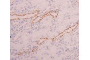Used in DAB staining on fromalin fixed paraffin- embedded kidney tissue (PDE3A Antikörper  (AA 948-1141))