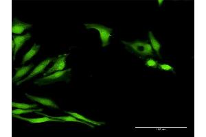 Immunofluorescence of purified MaxPab antibody to LOC541473 on HeLa cell. (LOC541473 Antikörper  (AA 1-131))