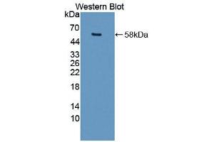 Western blot analysis of the recombinant protein. (MMP15 Antikörper  (AA 280-497))