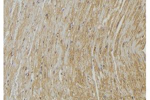 ABIN6272862 at 1/100 staining Mouse muscle tissue by IHC-P. (PLOD2 Antikörper  (C-Term))