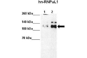 Western Blotting (WB) image for anti-Heterogeneous Nuclear Ribonucleoprotein U-Like 1 (HNRNPUL1) (C-Term) antibody (ABIN2779021)