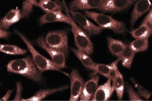 Immunofluorescent staining of HeLa cells. (PRKACA Antikörper  (AA 18-347))