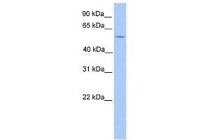 Western Blot showing LIMD1 antibody used at a concentration of 1. (LIMD1 Antikörper  (N-Term))
