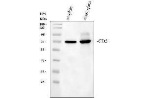 Western blot analysis of CD5 using anti-CD5 antibody (ABIN5693203).