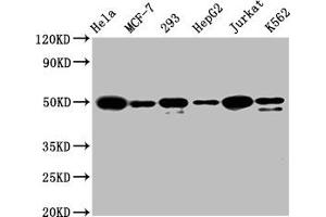 Western Blotting (WB) image for anti-Activating Transcription Factor 4 (Tax-Responsive Enhancer Element B67) (ATF4) antibody (ABIN7127347)