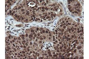 Image no. 2 for anti-Von Hippel-Lindau Tumor Suppressor, E3 Ubiquitin Protein Ligase (VHL) antibody (ABIN1501712)