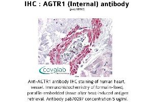 Image no. 1 for anti-Angiotensin II Receptor, Type 1 (AGTR1) (Internal Region) antibody (ABIN1731610) (Angiotensin II Type-1 Receptor Antikörper  (Internal Region))