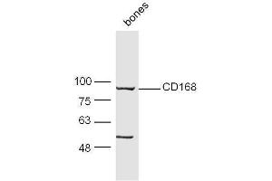 Mouse bone lysate 30ug, probed with Anti-CD168 Polyclonal Antibody  at 1:5000 90min in 37˚C. (HMMR Antikörper  (AA 51-150))