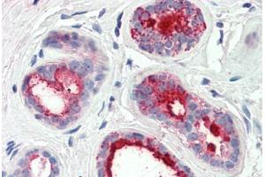 Human Breast (formalin-fixed, paraffin-embedded) stained with PIP antibody ABIN337224 at 2. (PIP Antikörper  (AA 24-34))