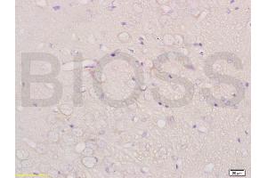 Formalin-fixed and paraffin embedded rat brain labeled with Anti-CHRNA4 Polyclonal Antibody, Unconjugated (ABIN736746) at 1:200 followed by conjugation to the secondary antibody and DAB staining. (CHRNA4 Antikörper  (AA 531-627))