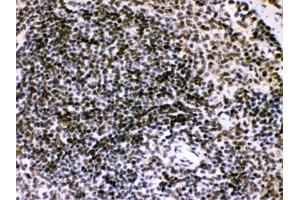 IHC testing of FFPE mouse spleen with BIK antibody. (BIK Antikörper  (AA 1-123))