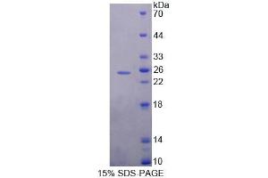 SDS-PAGE analysis of Mouse MEF2A Protein. (MEF2A Protein)