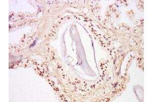 Formalin-fixed and paraffin embedded human prostate tissue labeled with Anti-FOXA2/HNF 3beta Polyclonal Antibody, Unconjugated  at 1:300 followed by conjugation to the secondary antibody and DAB staining. (FOXA2 Antikörper  (AA 201-300))