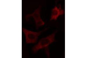 ABIN6274663 staining LOVO cells by IF/ICC. (CYP7B1 Antikörper  (Internal Region))