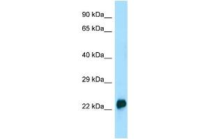 WB Suggested Anti-CRYGA Antibody Titration: 1.
