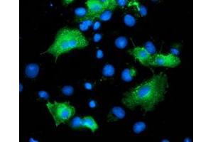 Anti-ARFGAP1 mouse monoclonal antibody (ABIN2454382) immunofluorescent staining of COS7 cells transiently transfected by pCMV6-ENTRY ARFGAP1 (RC206987). (ARFGAP1 Antikörper)