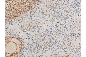 Immunohistochemistry (IHC) image for anti-Myc Proto-Oncogene protein (MYC) (pSer62) antibody (ABIN6255431)