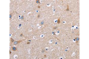 Immunohistochemistry (IHC) image for anti-Fibronectin 1 (FN1) antibody (ABIN2420900) (Fibronectin 1 Antikörper)