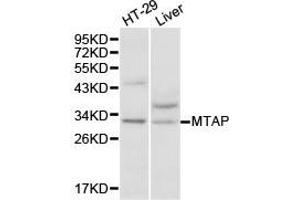Western Blotting (WB) image for anti-Methylthioadenosine phosphorylase (MTAP) antibody (ABIN1875403) (MTAP Antikörper)