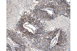 IHC analysis of Claudin 3/CLDN3 using anti-Claudin 3/CLDN3 antibody (ABIN7599626). (Claudin 3 Antikörper  (AA 101-220))