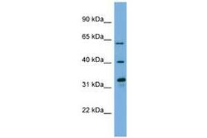 Image no. 1 for anti-Flavin Containing Monooxygenase 3 (FMO3) (N-Term) antibody (ABIN6744773) (FMO3 Antikörper  (N-Term))