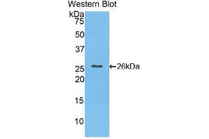 Western blot analysis of the recombinant protein. (Cardiotrophin 1 Antikörper  (AA 1-203))