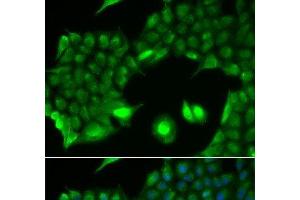 Immunofluorescence analysis of HeLa cells using SSX2 Polyclonal Antibody