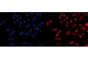IF analysis of HDAC2 using anti-HDAC2 antibody (ABIN7601564). (HDAC2 Antikörper  (AA 387-488))