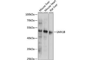 Western blot analysis of extracts of various cell lines, using LMX1B antibody (ABIN6133792, ABIN6143278, ABIN6143281 and ABIN6218228) at 1:1000 dilution. (LMX1B Antikörper  (AA 1-100))